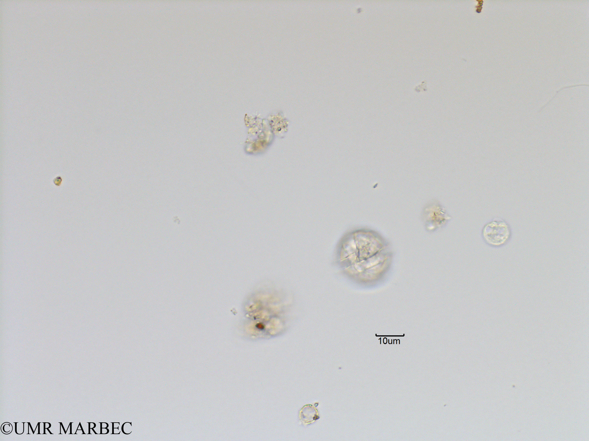 phyto/Bizerte/bizerte_lagoon/RISCO November 2015/Alexandrium sp6 (Lagune_T5_ACW3 _alexandrium-2).tif(copy).jpg
